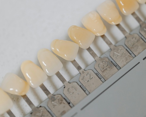 How Long Do Dental Veneers Last? Understanding Their Lifespan And Maintenance